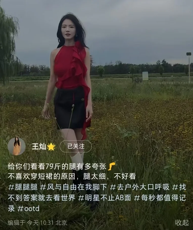 杜淳老婆暴瘦不足80斤，穿短裙瘦成“闪电”，长腿细得像麻杆